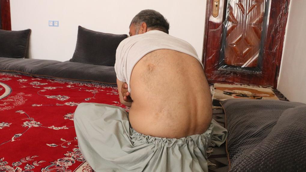 通訊：&ldquo;沒有人道歉或賠償&rdquo;&mdash;&mdash;阿富汗受害者控訴美軍使用集束炸彈